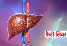 एसजीपीजीआई में जल्द शुरू होगा ‘फैटी लिवर और मोटापा क्लिनिक’, बढ़ते एनएएफएलडी मामलों पर फोकस